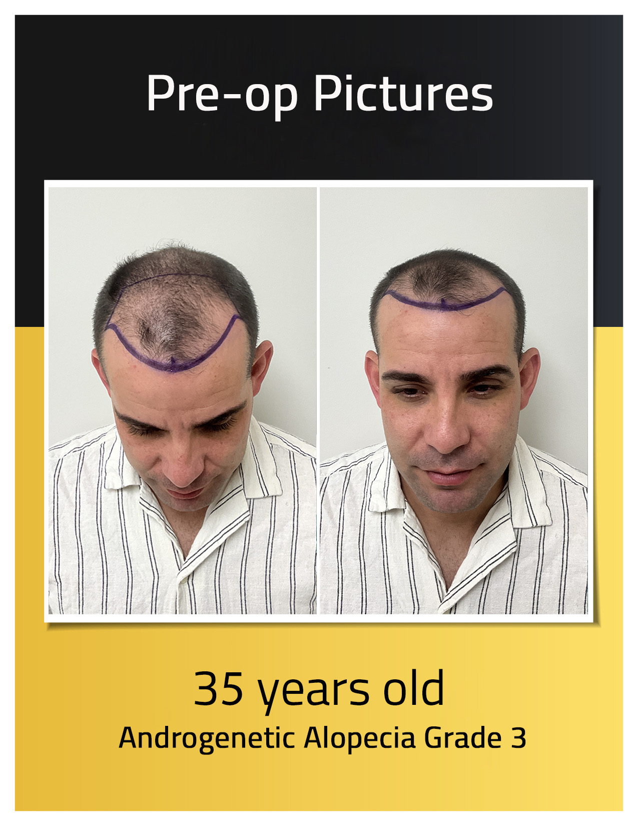 loivwer fotos preoperatorias