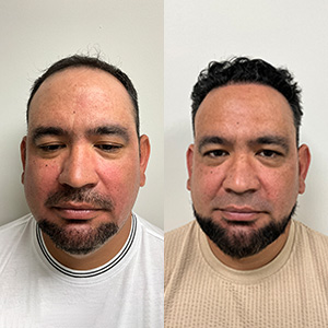 Luis Sanchez Transformación del Cabello Antes y Después