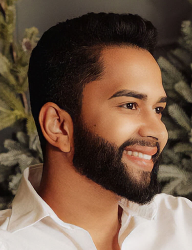 beard restoration before and after