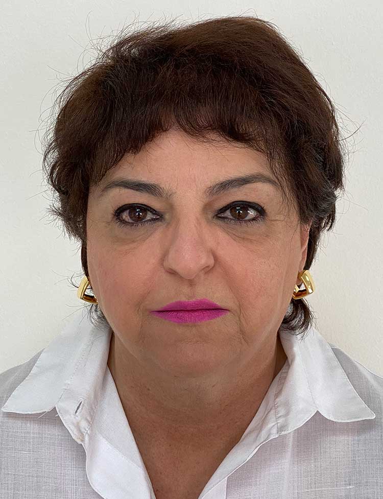 NeoGraft hair transplant female patient after