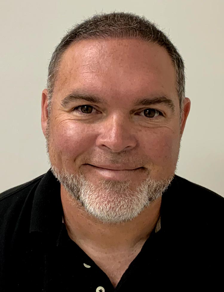 Foto después de la restauración capilar con técnica FUE de zafiro