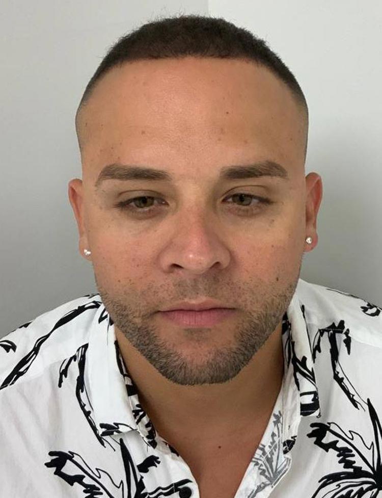 Trasplane DHI foro de despues