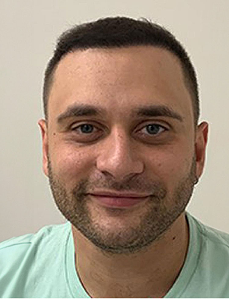 restauración del cabello paciente real despues