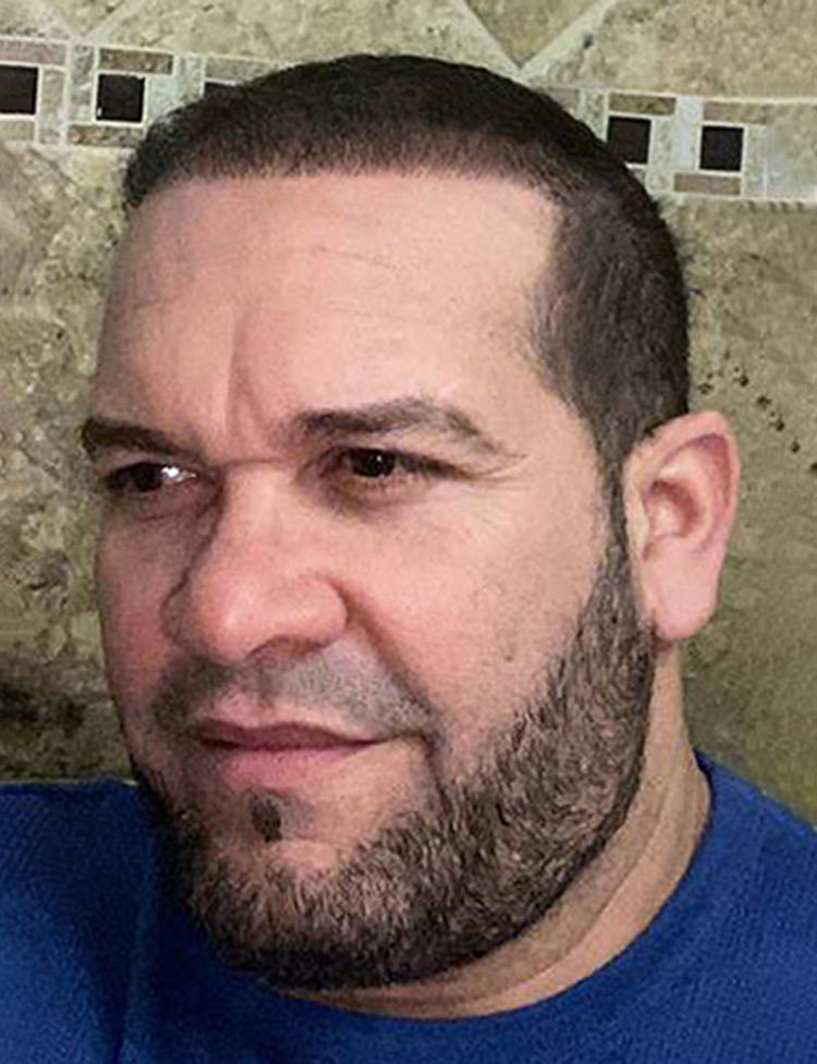 hair restoration 42 years old patient after photo