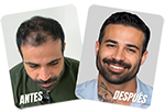 Combo combina y ahorra $1,20 por foliculo