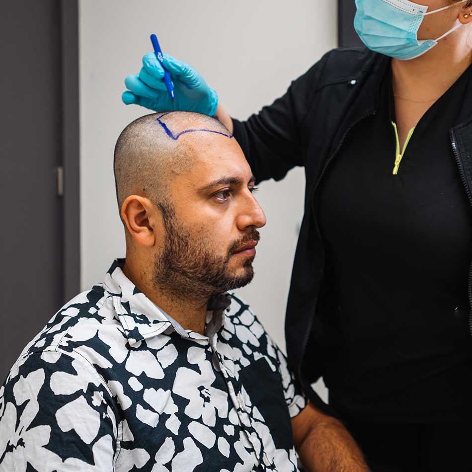 hair transplant patient