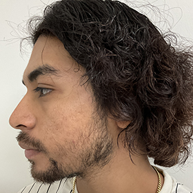 jorge antes de su reconstrucción de barba
