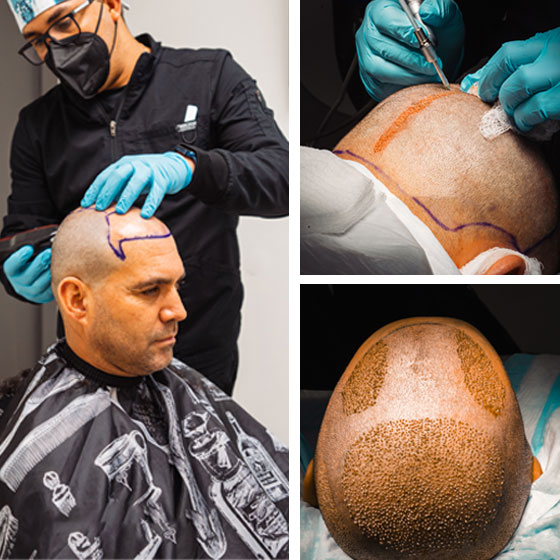 paciente en la locacion de miami