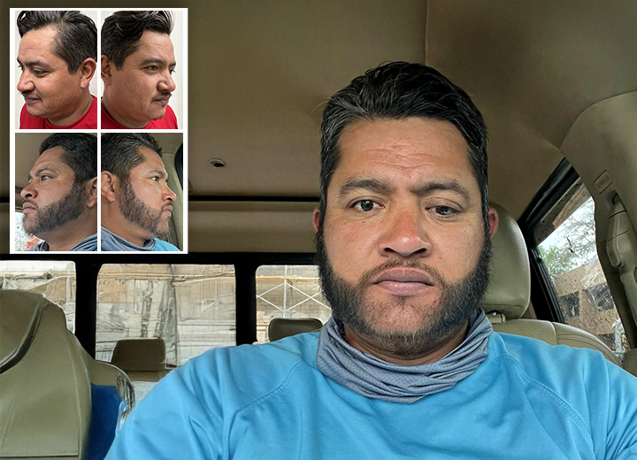 Reconstrucción de barba desde cero