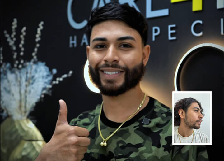 Reconstrucción de Barba de Jorge Luis