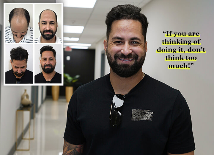 Rivaldo Life-Changing Hair Transplant