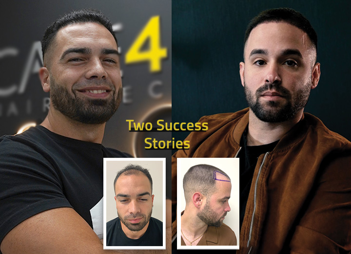 Yasiel and Jorge: Two Success Stories at Care4Hair