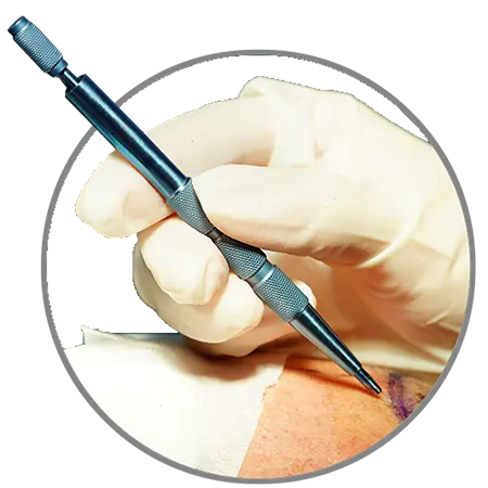 Sapphire Pen Implanter