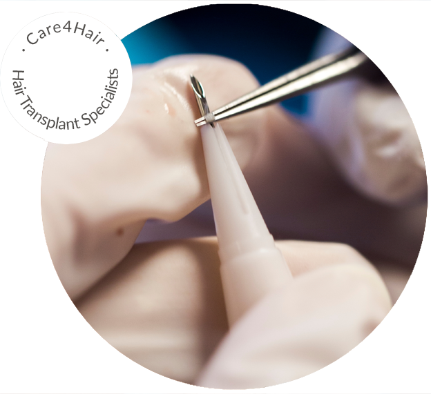 Choi Pen para Trasplante de pelo directo