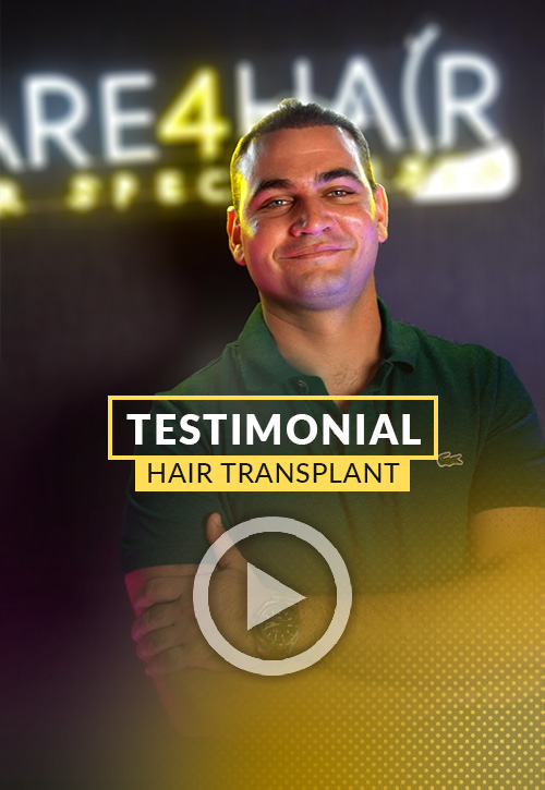 Carlos testimonial after his hair restoration in Miami