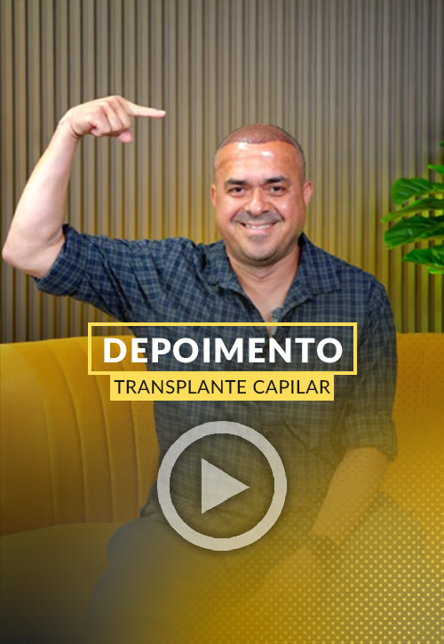 Depoimento de Alan, um de nossos pacientes do Brasil, após seu transplante capilar.