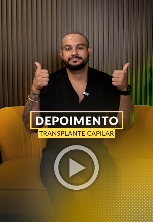 Depoimento de Ederson transplante capilar.