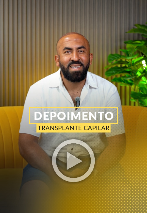 Depoimento de Fernando Santos transplante capilar.