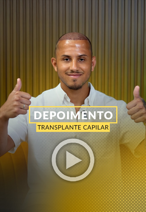 Depoimento de Mateus transplante capilar.