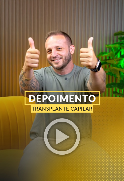 Depoimento de Rafael, tres meses desde o transplante capilar.