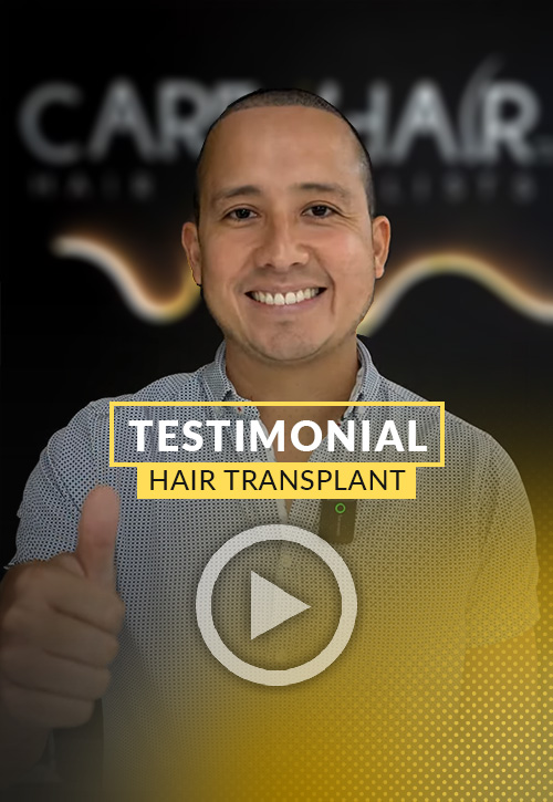 Gustavo Vento testimonial after his hair restoration in Miami