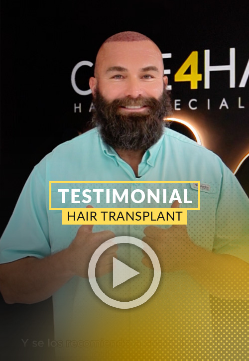 Testimonial after his hair restoration in Miami | Care4Hair