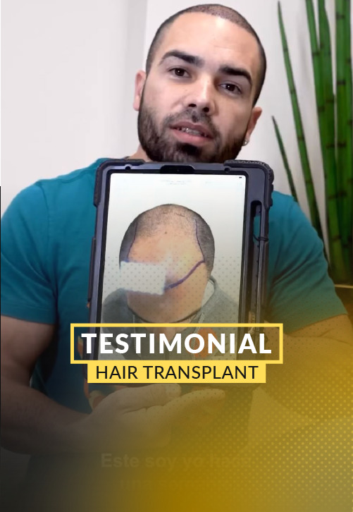 Yasiel’s 4,000-follicle hair restoration video testimony.