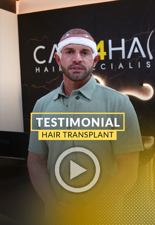 Adam Testimonial after his hair restoration in Miami | Care4Hair