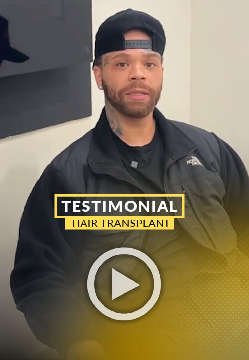 Hair Loss in crown area - Patient Testimony