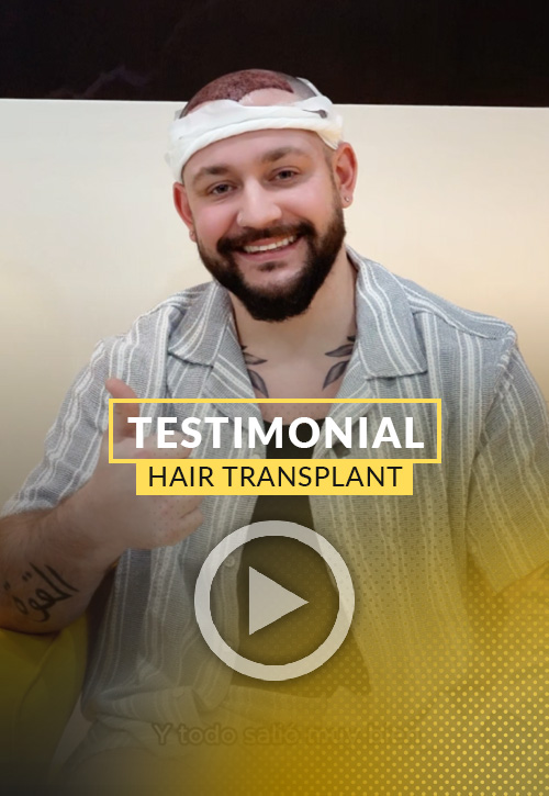 Joesph Testimonial after his hair restoration in Miami | Care4Hair
