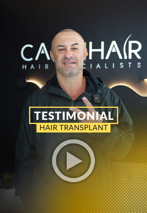 Carlos Ribero Testimonial after his hair restoration in Miami | Care4Hair