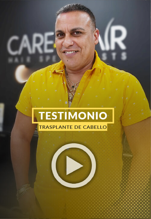 Testimonio de Paciente 4 meses despues de su trasplante de cabello en la linea frontal