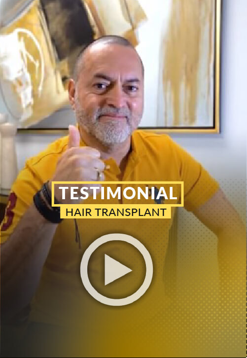 Video Testimony of 3000-grafts hair transplant surgery