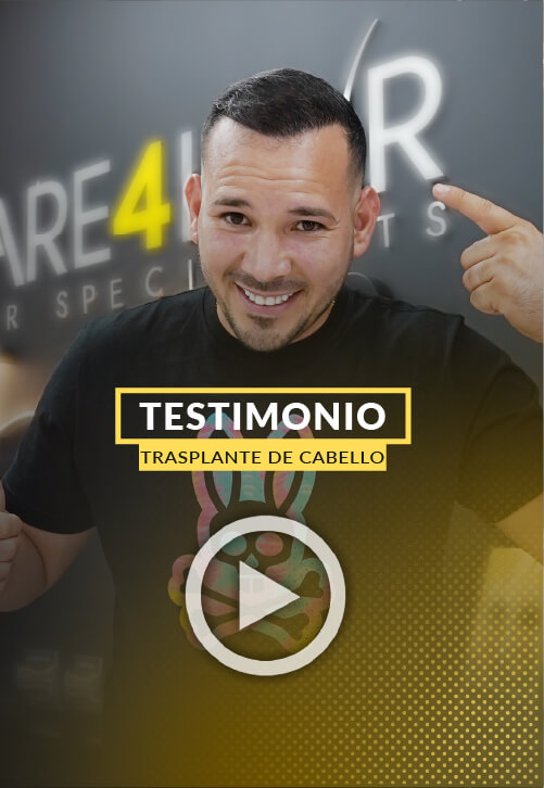 Video Testimonio de Leonardo - 4000 injertos 5 meses de la cirugia