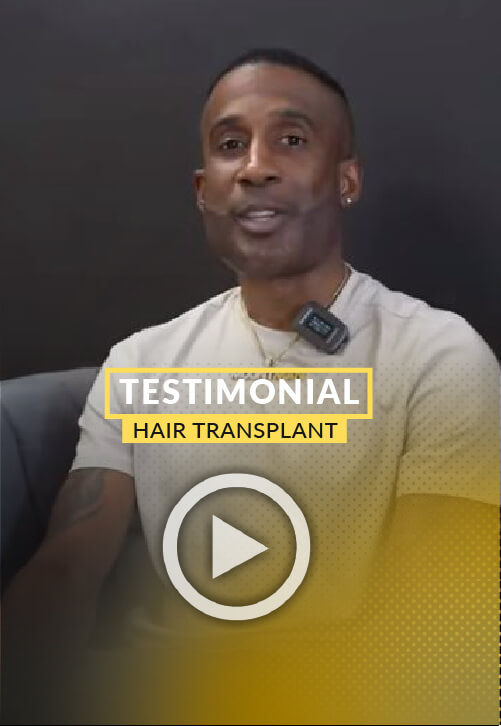 1-day post beard transplant procedure video testimony