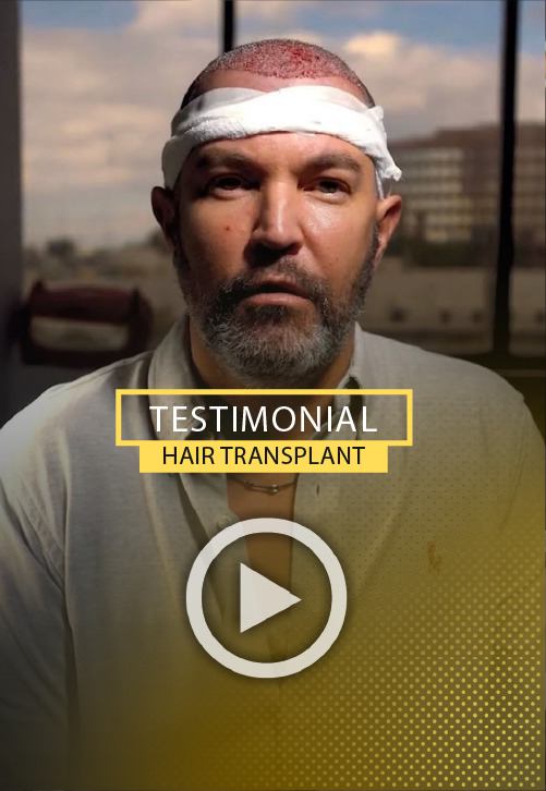 Hair Transplant at Care4hair Video Testimony