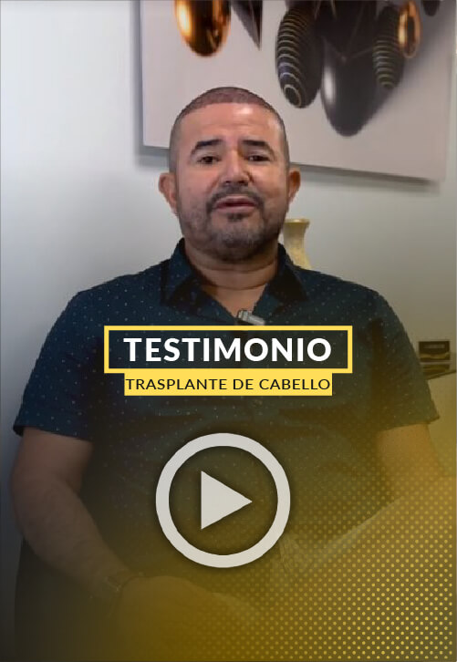 Testimonio de paciente - 2500 foliculos de pelo trasplantados