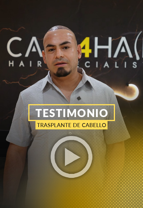 Testimonio de Edwin Perez después de su restauración capilar en Miami | Care4Hair