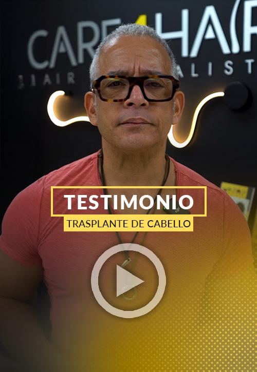 Testimonio de Felipe después de su restauración capilar en Miami | Care4Hair
