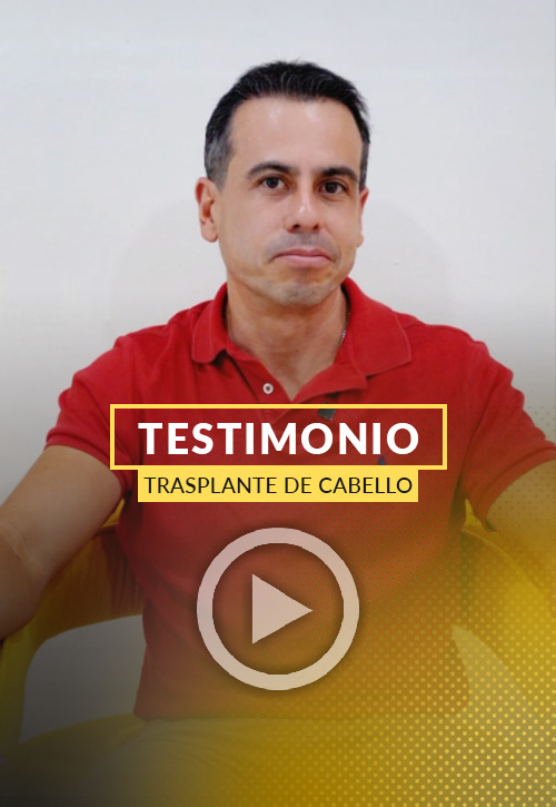 Testimonio de Iván Reyes después de su restauración capilar en Miami | Care4Hair