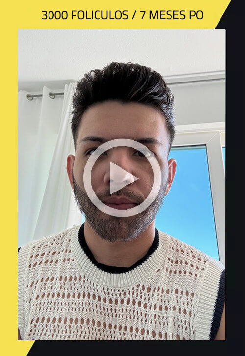 Antes y Después de uno de Nuestros Pacientes