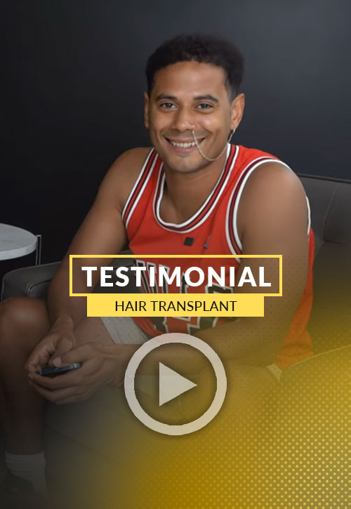 Video Testimonio de Paciente de Trasplante de Cabello con 5000 foliculos