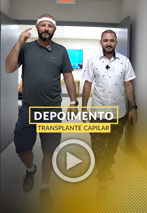 Video de Depoimento de Transplante Capilar em Miami