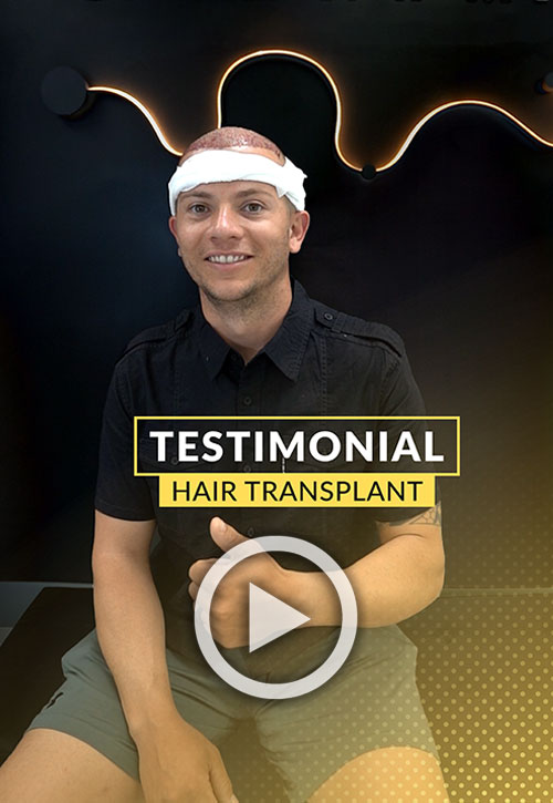 1500-grafts hair transplant surgery - video testimonial