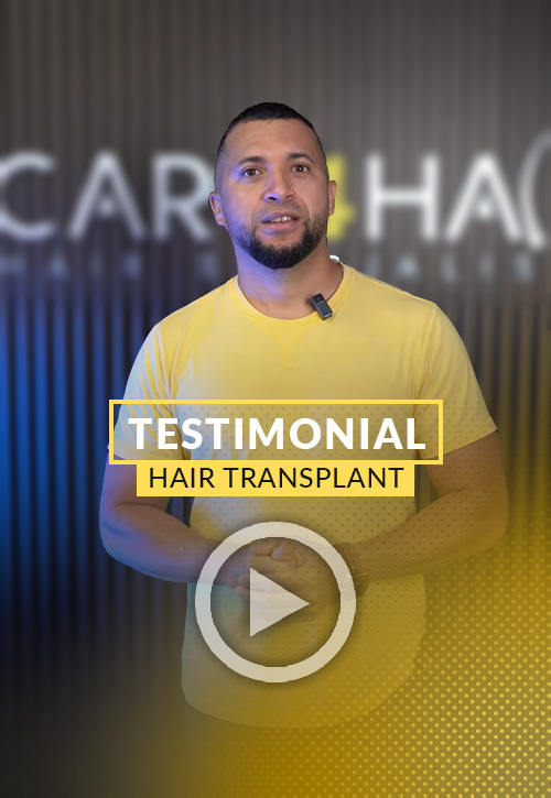 Testimonial after his hair restoration in Miami