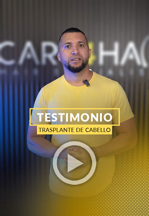 Video Testimonio de Paciente de Trasplante de Cabello