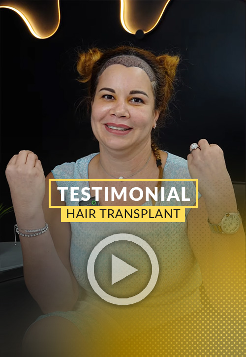 woman testimonial after his hair restoration in Miami